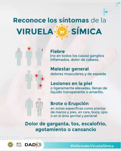 Cuarto caso de viruela símica en Cartagena