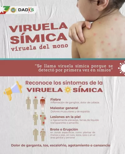 Viruela